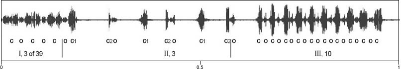 waveform