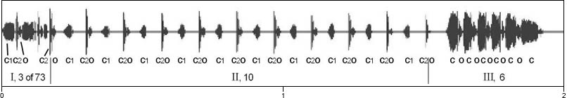 waveform