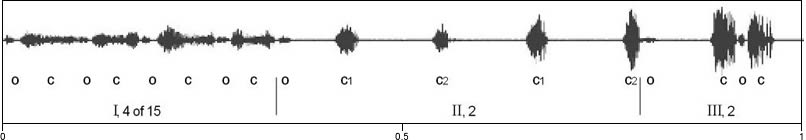 waveform