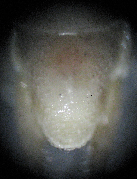 subgenital plates comparing males Oecanthus beameri and Oecanthus quadripunctatus